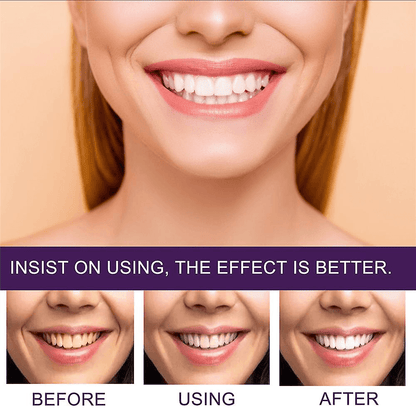 Purple Whitening Toothpaste Yellow Teeth Stains Removal - 50ml