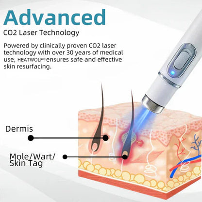 xorita mole and wart remover